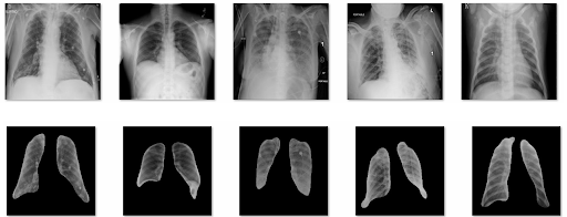 Segmented Lung Images